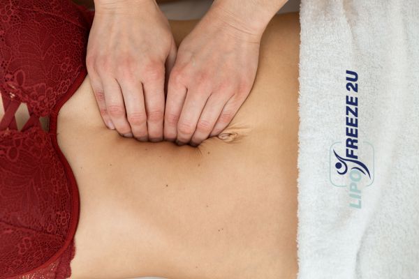 diastasis recti treatment Ramsgate