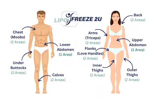 Areas you can have fat freezing treatment Ramsgate