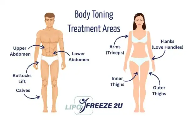 Graphic showing where you can have Body toning Treatment Ramsgate on your body