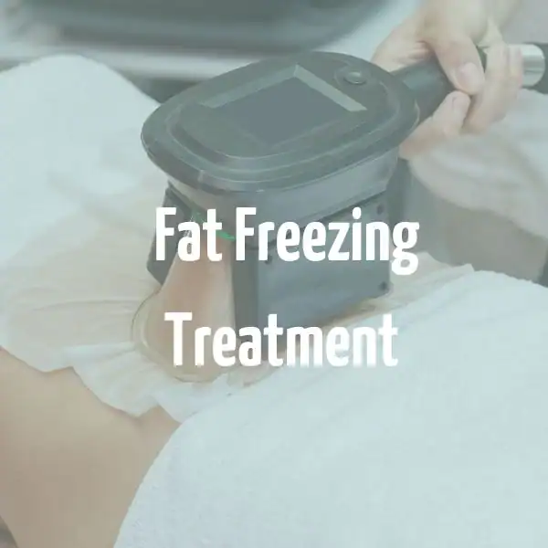 fat freezing treatment Ramsgate