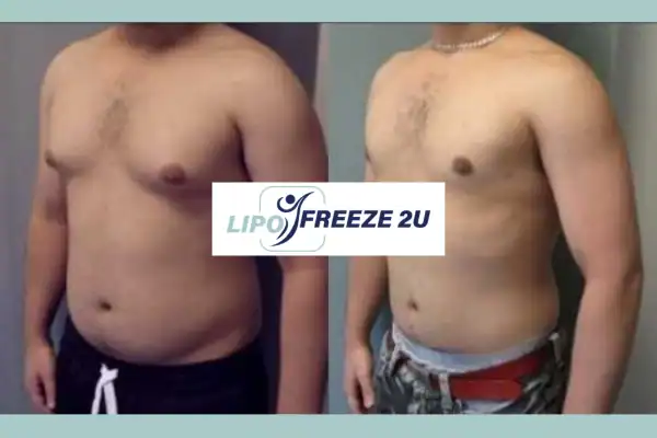 How Long Does It Take to See Results Ramsgate?