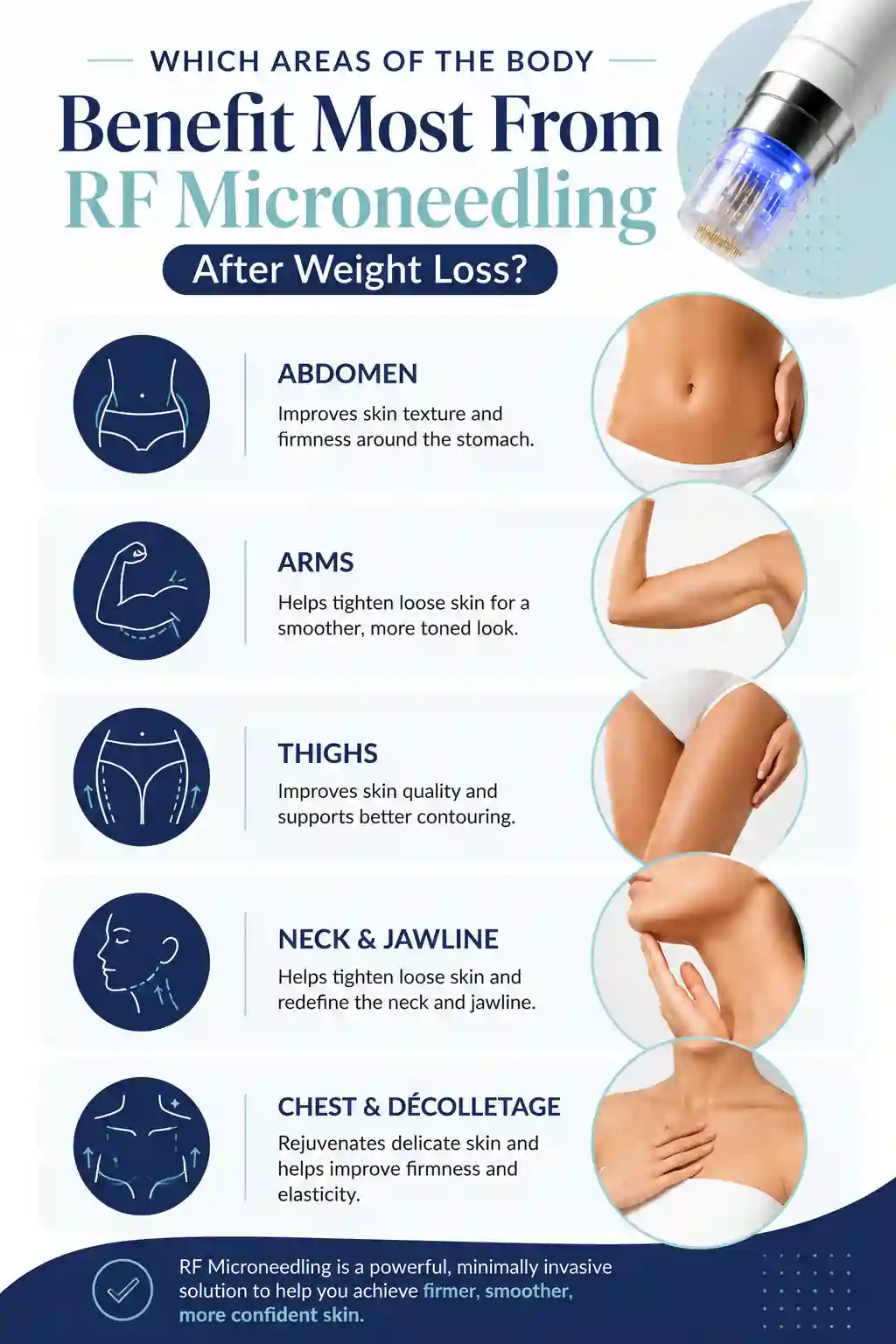 Which Areas of the Body Benefit Most From RF Microneedling After Weight Loss Ramsgate